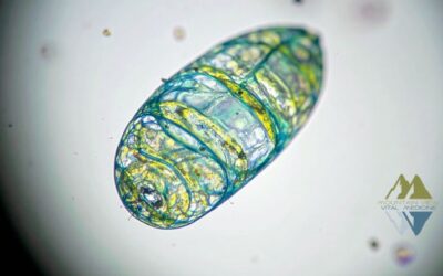 Mitochondrial Dysfunction and Chronic Disease